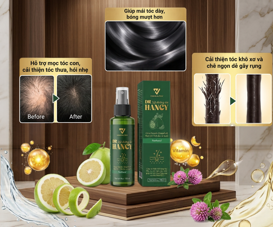 Xịt dưỡng tóc Dr Hancy – giải pháp hỗ trợ chân tóc chắc khỏe, giảm rụng