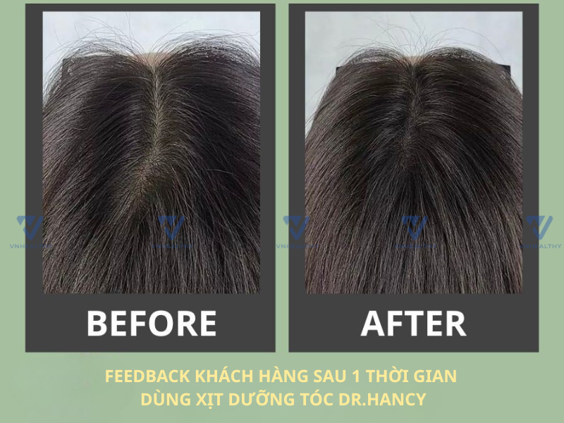 Xịt dưỡng tóc Dr Hancy
