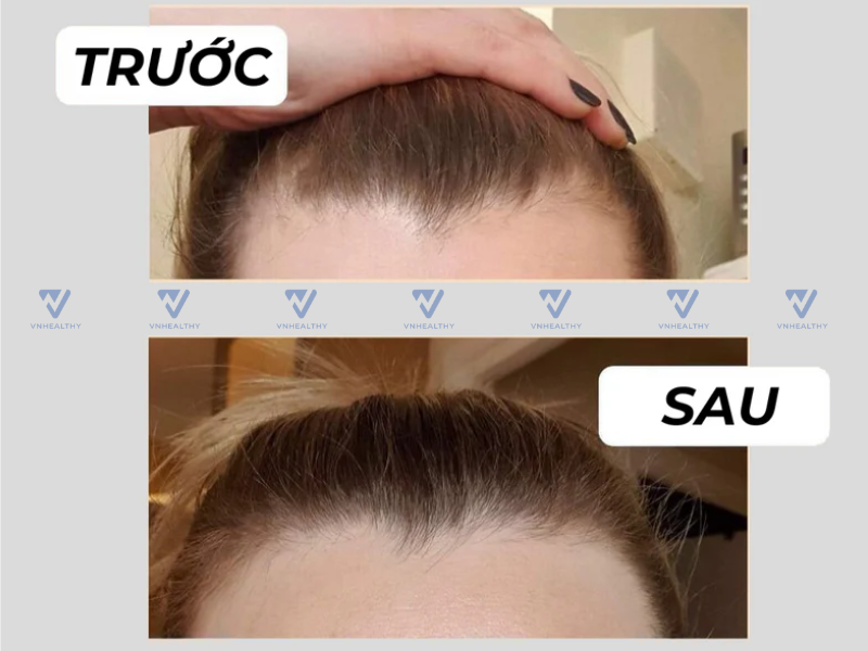 Xịt dưỡng tóc Dr Hancy