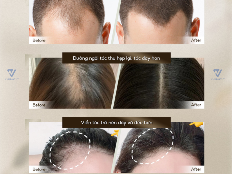 Xịt dưỡng tóc Dr Hancy
